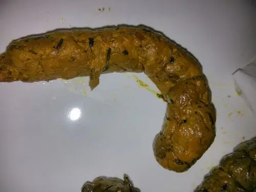 这样大便正常吗