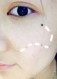 北斗七星痣好不好,北斗七星痣有什么寓意!