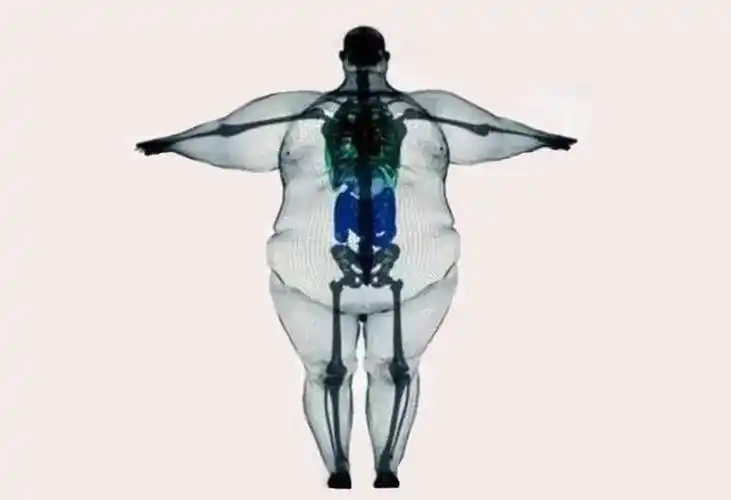 大骨架怎么办?虽然你减不