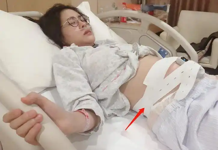 未出生的婴儿图片(张碧晨) - 乐宝宝贝