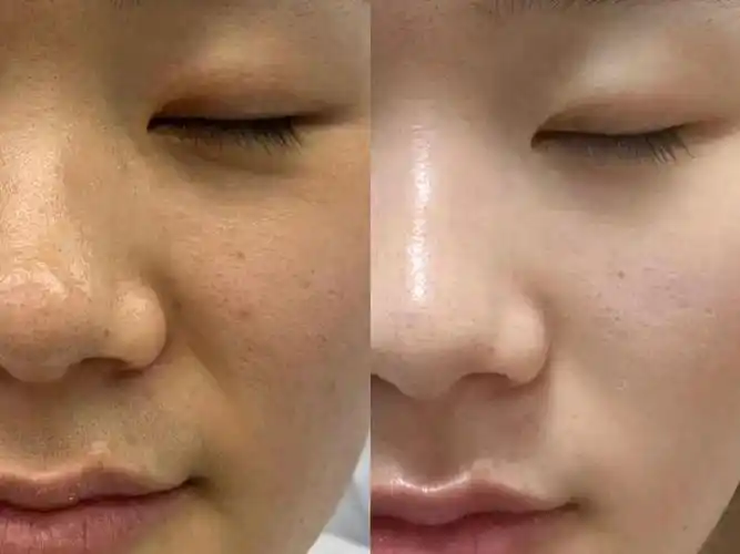 lina李娜白大褂推荐的美白面霜悠着点用!