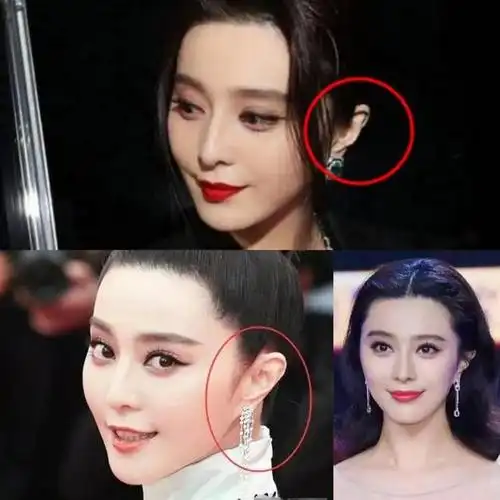 比较好,也不容易随着季节的变换而生病,所以面相精灵耳朵是健康的象征