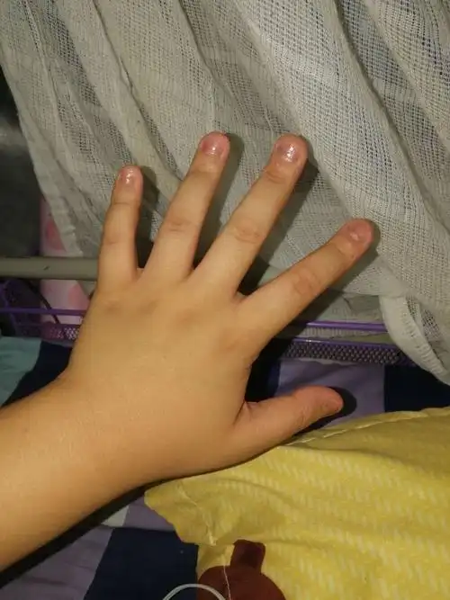 为什么我改不掉自己咬指甲的习惯? - 知乎