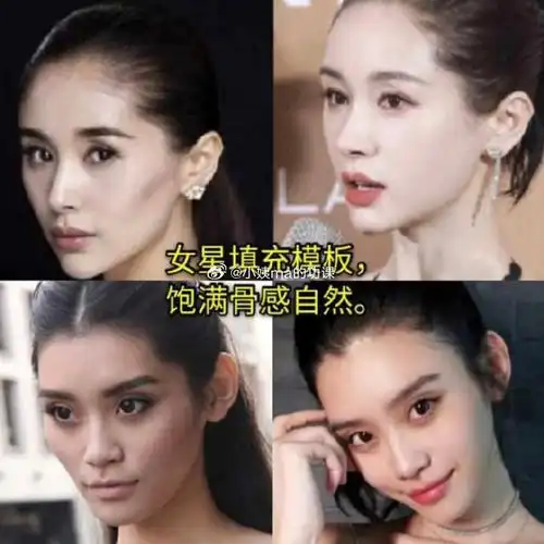 北京脂肪填充##北京自体脂肪丰胸