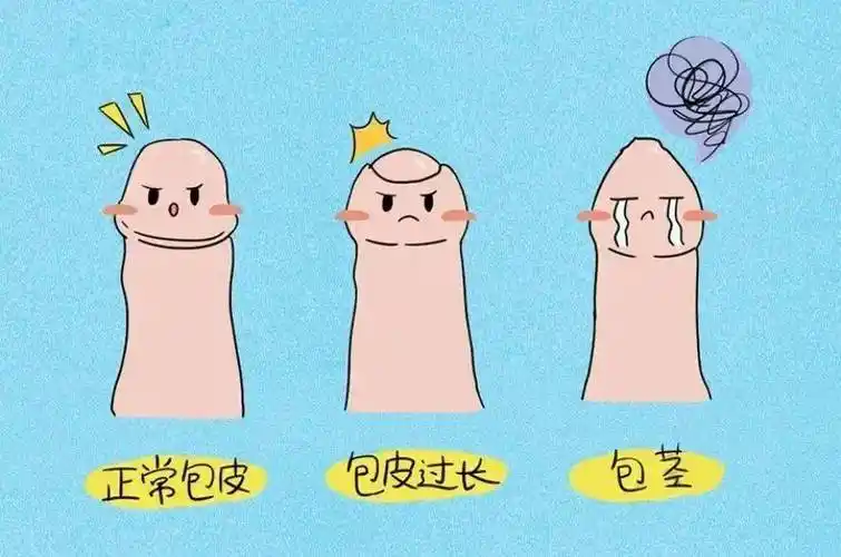 其实,家长们不要着急,小儿包皮过长和包茎的问题不能简单粗暴地"一刀