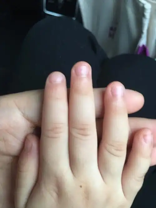 四周岁吃手正常吗咬指甲怎么办