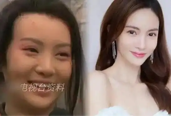 其中最为广泛的就是关于金晨整容的质疑