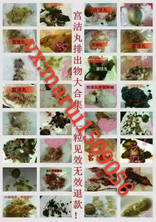 d女郎缩阴治疗妇科炎症一步到位.