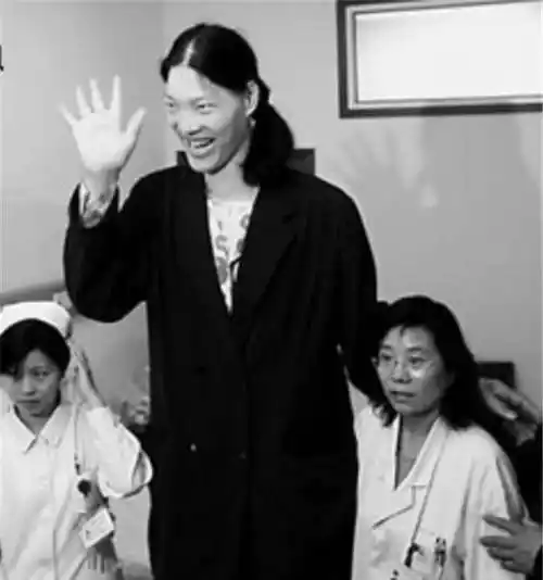 安徽"世界第一女巨人",穿78码的鞋子,一顿能吃两斤白米饭_姚德芬_身高