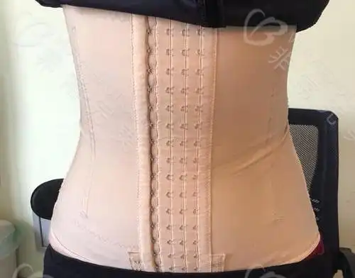 大腿腰腹吸脂后该穿什么样的塑身衣 需要穿多久 不穿会怎么样