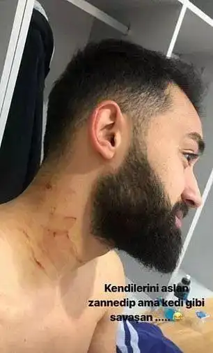 土耳其媒体则将卡拉尔称为"拿着刀片的恐怖分子".