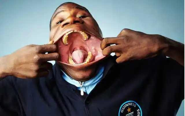 世界上嘴巴最小的女人,长度只有3厘米,就连吃饭都很困难!