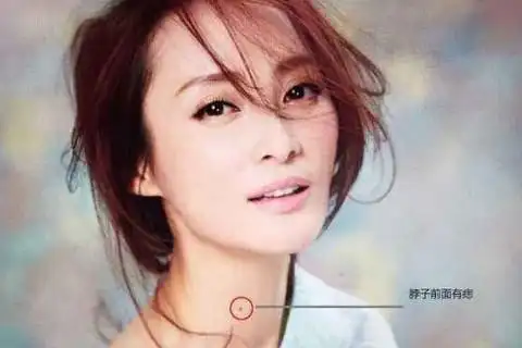 脖子有痣的人命运如何