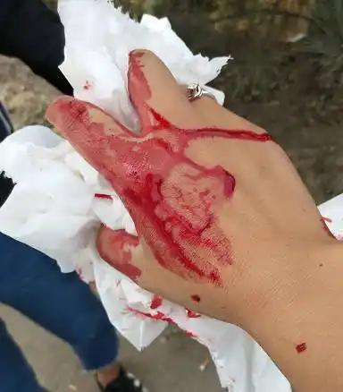 被打的满脸是血,孩子吓得不轻!永清女子寻找打人电动三轮司机!