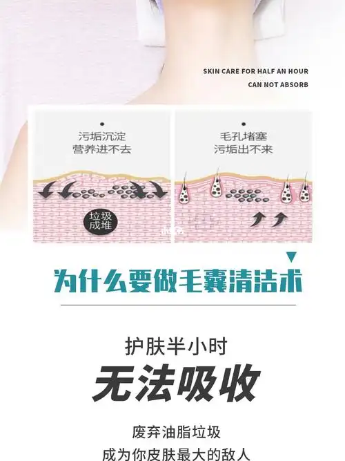 禾壹净毛囊清洁术