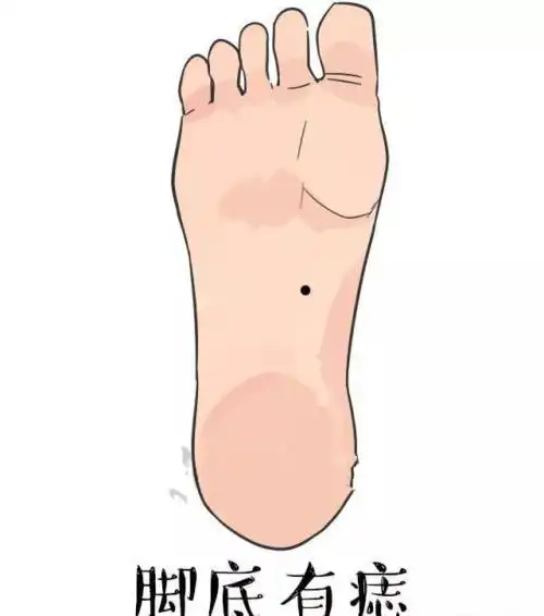 注意痣的位置 左脚脚心有痣的女人