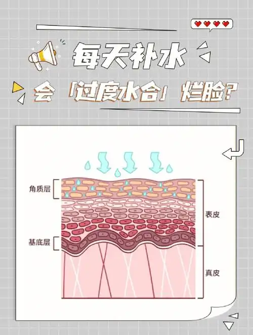 差不多,过度水合大部分都是面膜或者湿敷太勤601508什么是皮肤