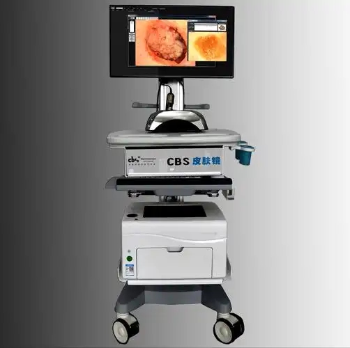 皮肤镜,皮肤照"妖"镜