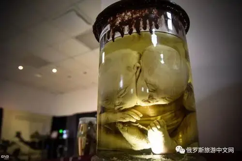 这些恐怖的畸形怪胎展,居然是俄罗斯圣彼得堡著名博物馆的"镇馆之宝"!
