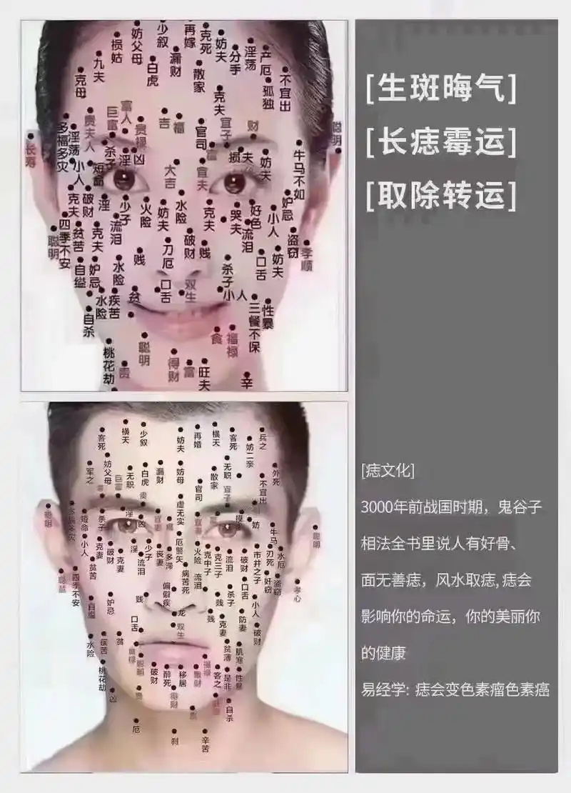 男人面部痣相最准图左右 - 抖音