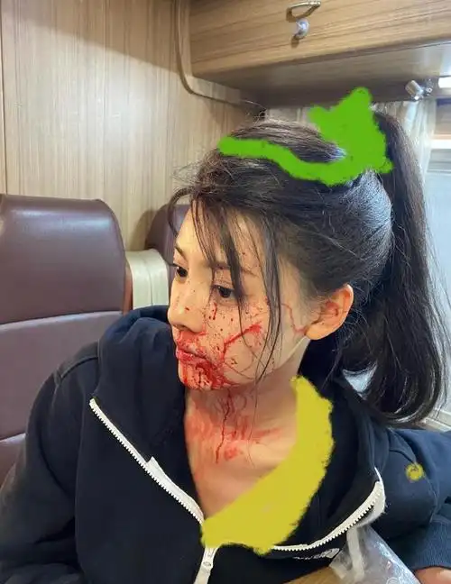 黄景瑜前妻王雨馨凌晨自杀,两人已离婚两年,迪丽热巴新剧被影响