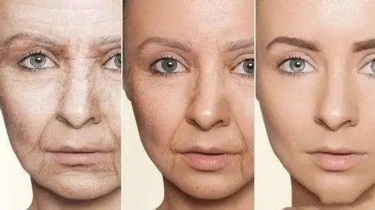 如何对抗不可避免的面部衰老进程_皮肤松弛_介绍_缓解方法 - 好大夫