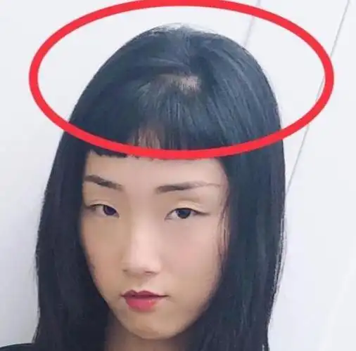 火箭少女101的yamy,换了新发型之后,粉丝也发现她头顶发量稀疏,还露了