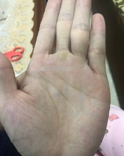 金星丘有痣富裕之象只要持之以恒好日子等着你