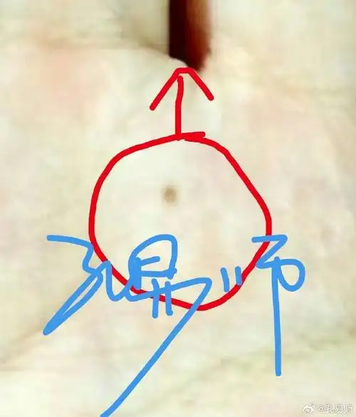 痣相～～财宫痣