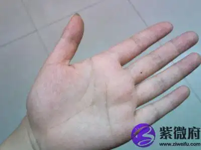 中指有痣各代表什么