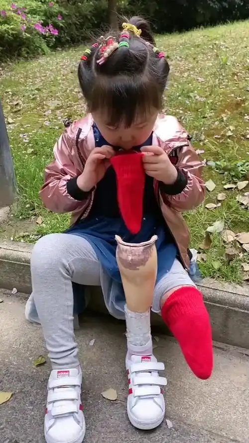 6岁小女孩自己穿戴假肢,动作熟练得让人心疼!