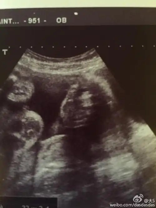 大s晒二胎儿子b超似点赞 称结婚五年不易