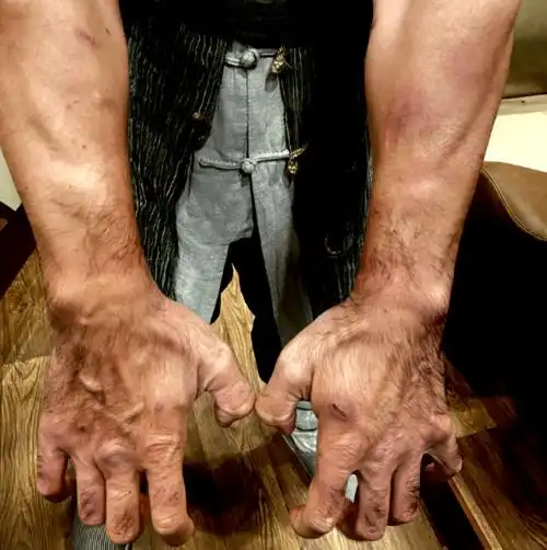 如今的他,却伤痕累累._樊少皇_因为_樊梅