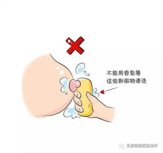 乳头皲裂怎么办?