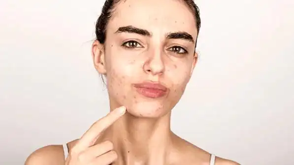 肌肤过敏的原因是因为肤质干燥,导致防护机能降低,只要去除多余的皮脂