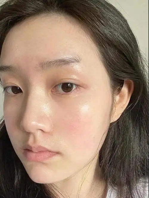 油性皮肤的人,真的会有很多烦恼:出去出个饭就满脸油光,时不时就冒痘