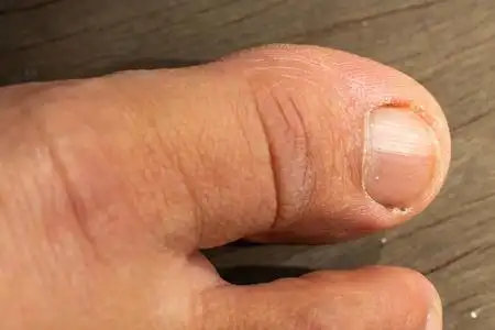 美女大脚趾图片