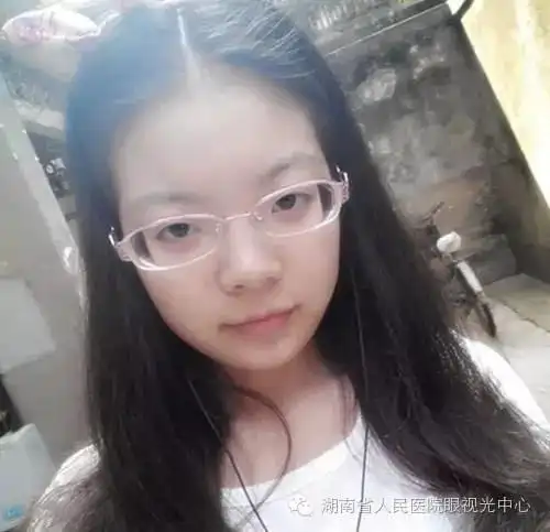 22岁的匡女士遗传父母的高度近视,从读小学双眼已经患上近视,并且