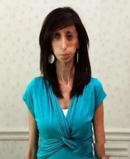 世界上最瘦的女人是谁kseniyabubenko皮包骨头的图片