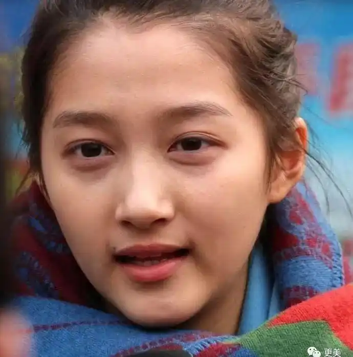 明星早先带牙套的照片让你哭笑不得,有勇气看完吗?看完还爱你的爱豆