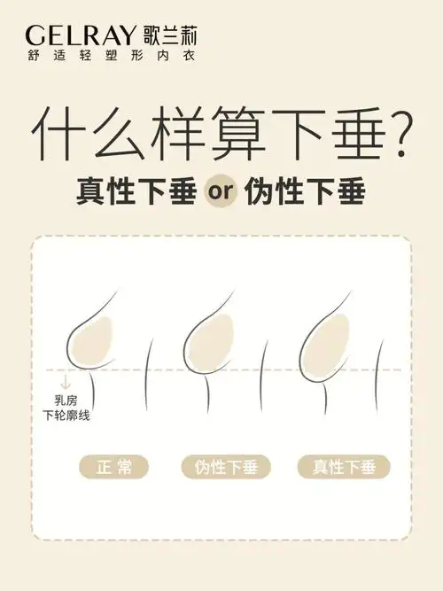 什么样算胸下垂你的胸是真的下垂吗