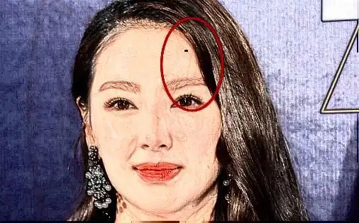 女人五大克夫痣败家败运趁早点掉