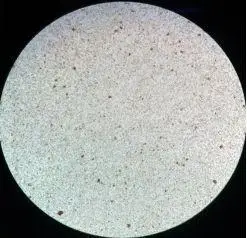 凝聚胺法交叉配血次侧凝集怎么破?有图有真相!