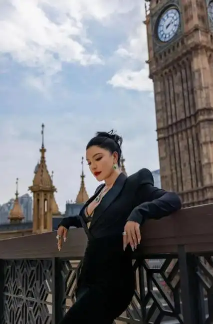 回顾超女冠军江映蓉因整容失败像怪物全身只剩眼珠是自己的