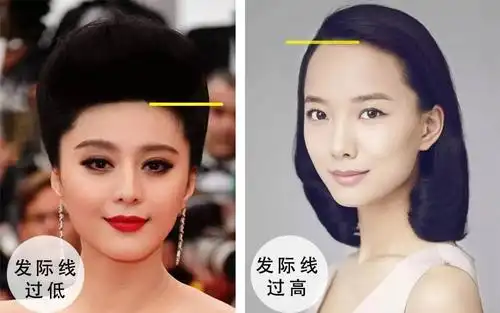 因为发际线虽然看着是属于头发的一部分,实际上却对面部比例产生了