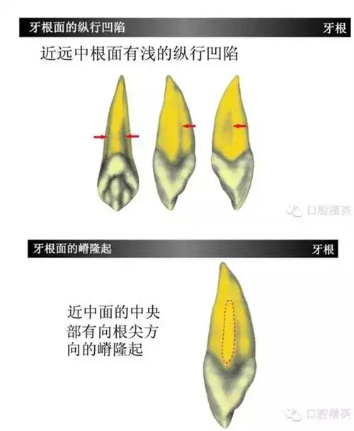上颌尖牙(上3)如此复杂?学习了