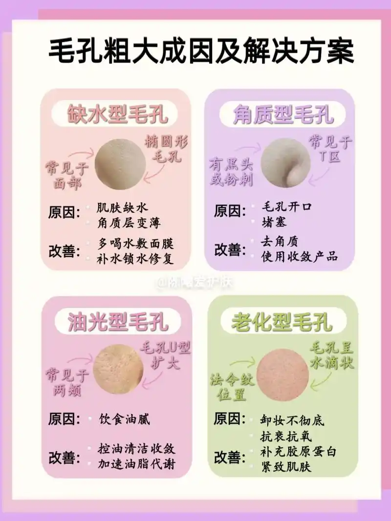 毛孔粗大是什么原因引起的,如何改善.