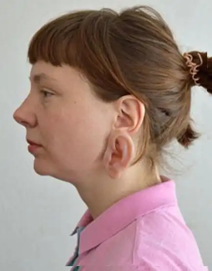 女子长出三个耳朵六个手指相貌恐怖,而背后真相让人惊讶不已