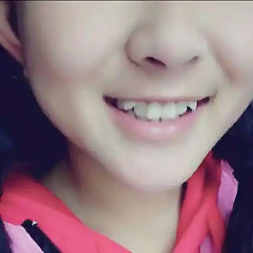 我的小孩上排牙齿有一颗虎牙,应该怎么办才好?