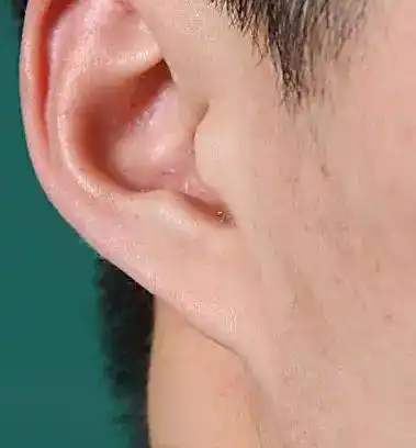 耳朵代表肾和一个人心性,耳朵薄,耳朵小,普遍肾气不足,不持久;耳骨反